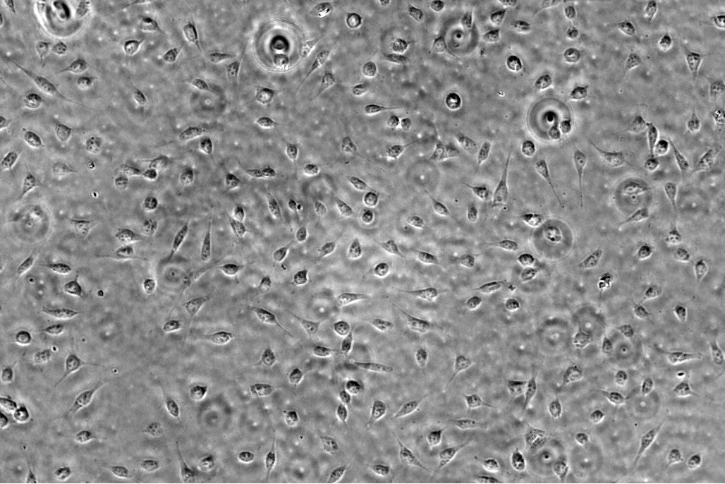 Phase Contrast — Live Cells