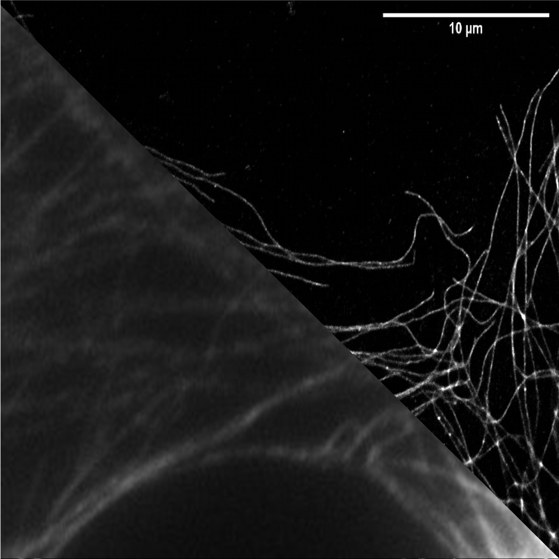 Super-Resolution — dSTORM